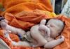 Вважають втіленням бога Вішну: в Індії народилася дитина з чотирма руками та ногами