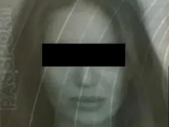 «Як у фільмі жахів»: росіянка відкусила частину пальця британській туристці на пляжі